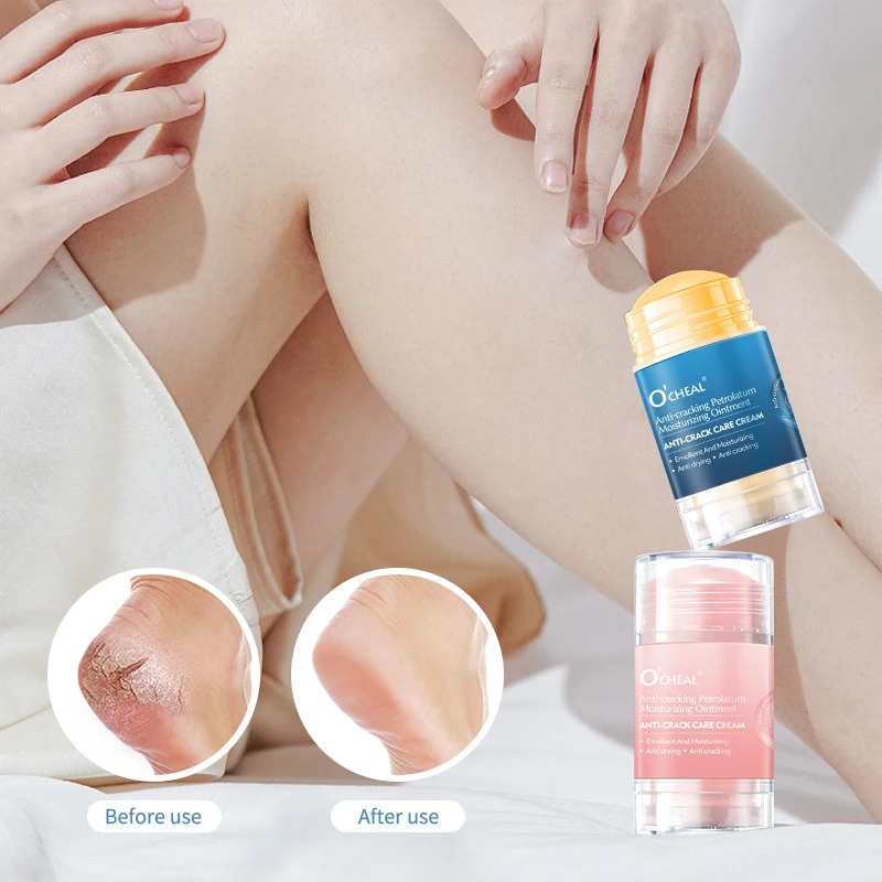 Crème anti-fissures pour pieds - Heels avis et prix